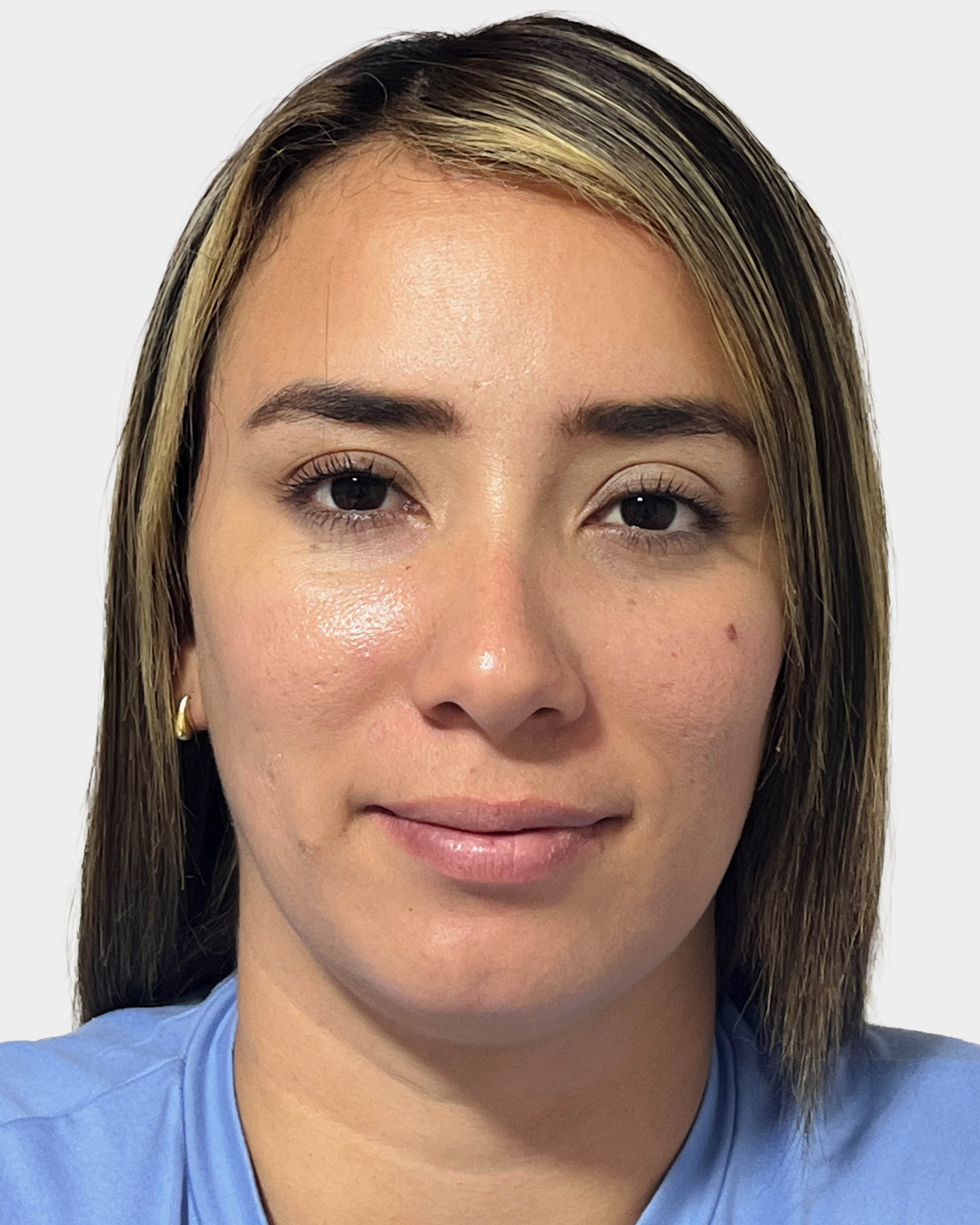 Después de Retiro de Lunares